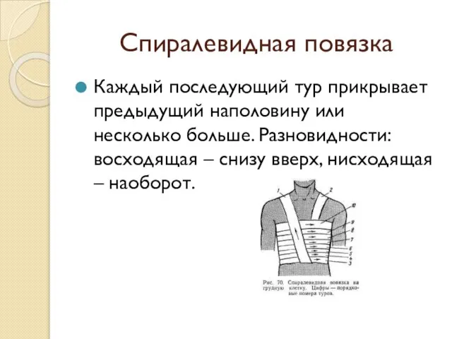 Спиралевидная повязка Каждый последующий тур прикрывает предыдущий наполовину или несколько больше. Разновидности: