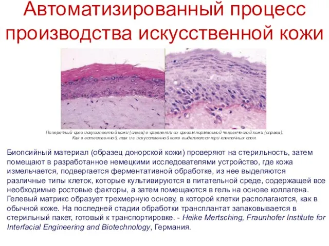 Автоматизированный процесс производства искусственной кожи Биопсийный материал (образец донорской кожи) проверяют на