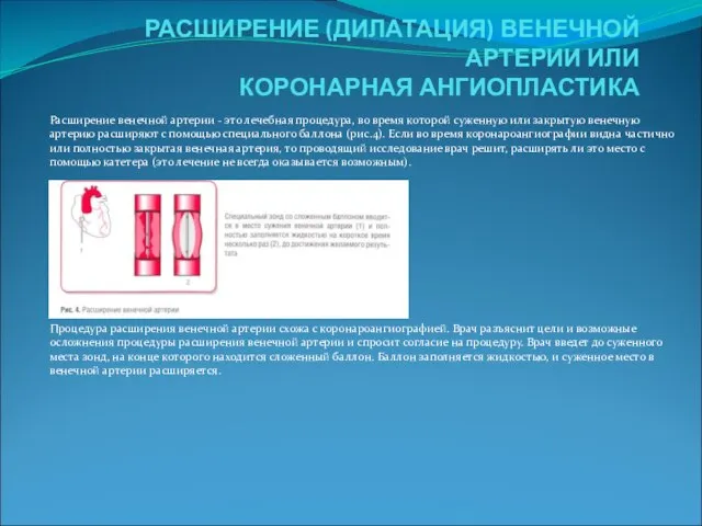 РАСШИРЕНИЕ (ДИЛАТАЦИЯ) ВЕНЕЧНОЙ АРТЕРИИ ИЛИ КОРОНАРНАЯ АНГИОПЛАСТИКА Расширение венечной артерии - это