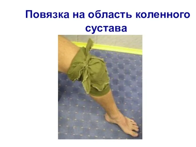 Повязка на область коленного сустава
