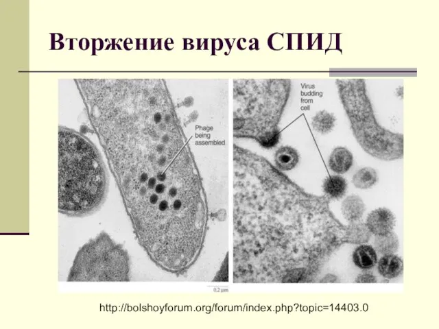 Вторжение вируса СПИД http://bolshoyforum.org/forum/index.php?topic=14403.0