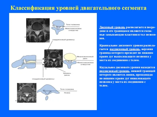 Классификация уровней двигательного сегмента Дисковый уровень располагается посре- дине и его границами