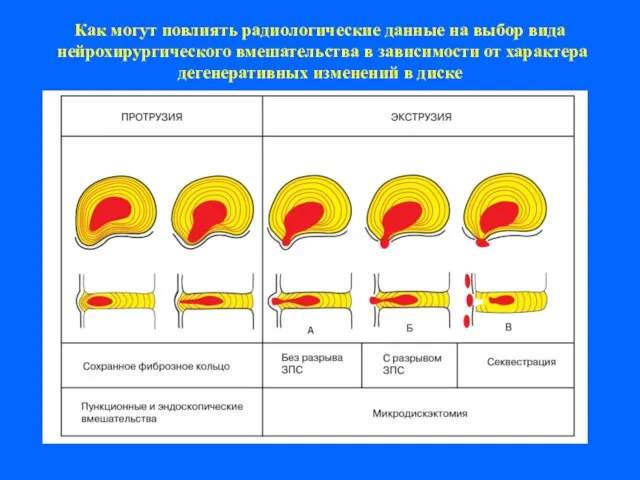 Как могут повлиять радиологические данные на выбор вида нейрохирургического вмешательства в зависимости