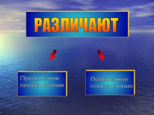 Продольное плоскостопие Поперечное плоскостопие РАЗЛИЧАЮТ