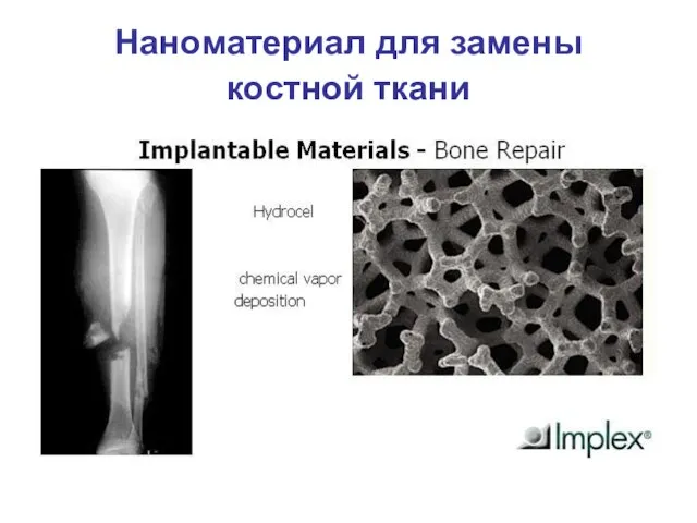 Наноматериал для замены костной ткани