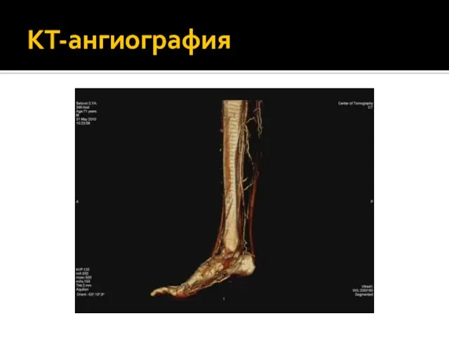 КТ-ангиография