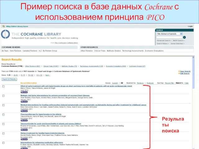 Пример поиска в базе данных Cochrane с использованием принципа PICO Результаты поиска