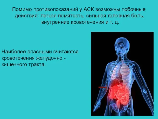 Помимо противопоказаний у АСК возможны побочные действия: легкая помятость, сильная головная боль,