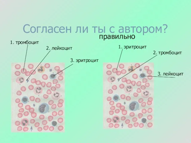 Согласен ли ты с автором? правильно 1. тромбоцит 2. лейкоцит 3. эритроцит