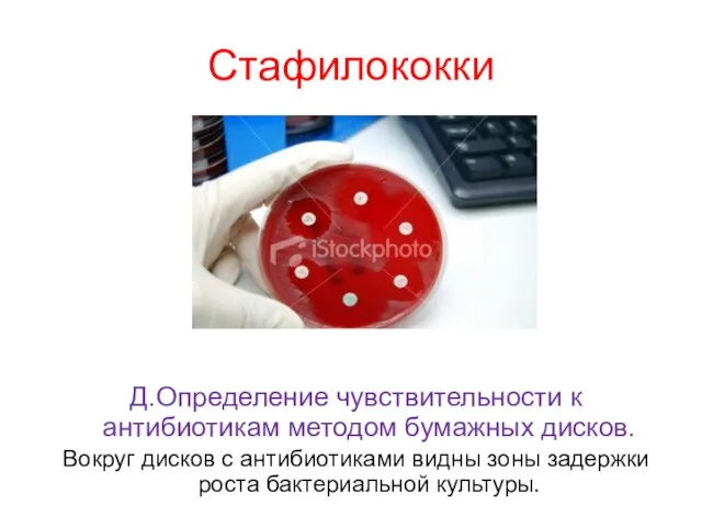 Стафилококки Д.Определение чувствительности к антибиотикам методом бумажных дисков. Вокруг дисков с антибиотиками