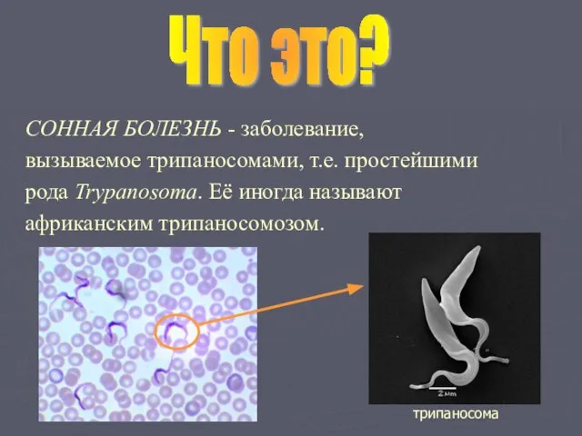 СОННАЯ БОЛЕЗНЬ - заболевание, вызываемое трипаносомами, т.е. простейшими рода Trypanosoma. Её иногда