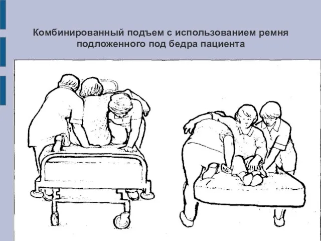 Комбинированный подъем с использованием ремня подложенного под бедра пациента