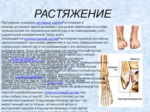 РАСТЯЖЕНИЕ Растяжение и разрыв суставных связокРастяжение и разрыв суставных связок возникают при