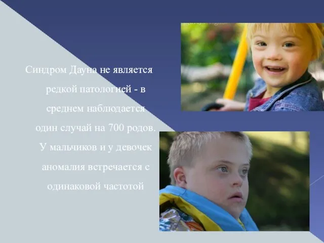 Синдром Дауна не является редкой патологией - в среднем наблюдается один случай