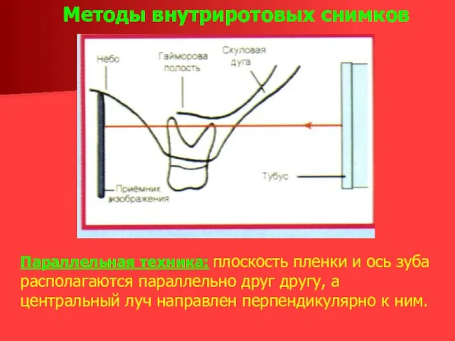 Методы внутриротовых снимков Параллельная техника: плоскость пленки и ось зуба располагаются параллельно