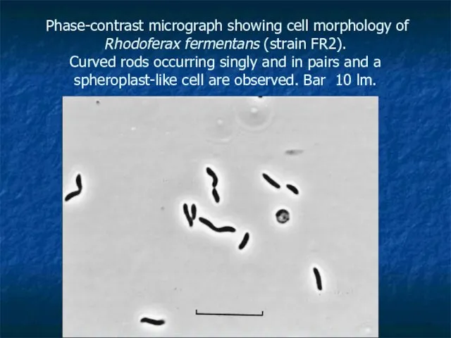 Phase-contrast micrograph showing cell morphology of Rhodoferax fermentans (strain FR2). Curved rods