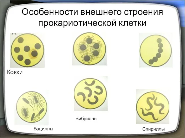 Особенности внешнего строения прокариотической клетки Кокки Бациллы Вибрионы Спириллы