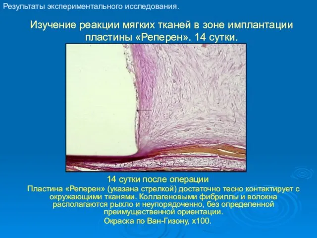 Изучение реакции мягких тканей в зоне имплантации пластины «Реперен». 14 сутки. 14