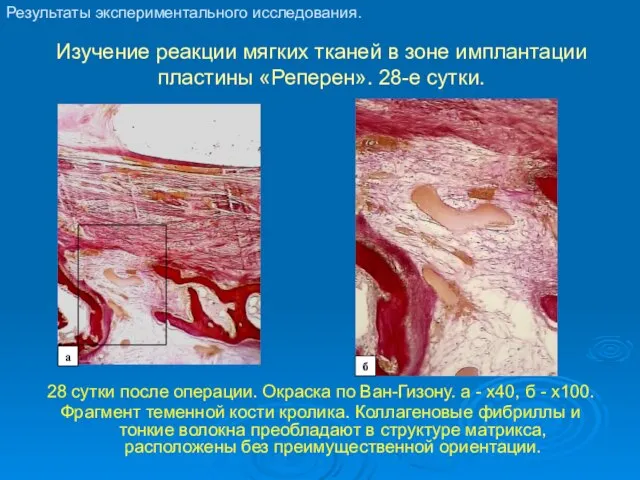 Изучение реакции мягких тканей в зоне имплантации пластины «Реперен». 28-е сутки. 28