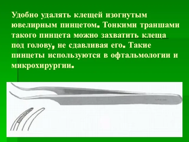 Удобно удалять клещей изогнутым ювелирным пинцетом. Тонкими траншами такого пинцета можно захватить