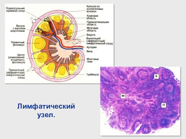 Лимфатический узел.