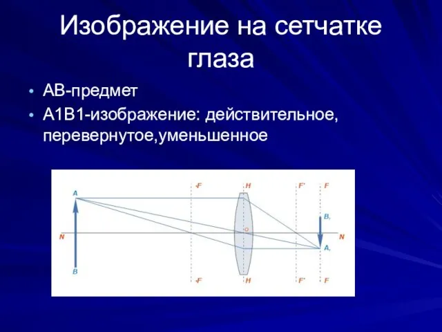 Изображение на сетчатке глаза АВ-предмет А1В1-изображение: действительное,перевернутое,уменьшенное