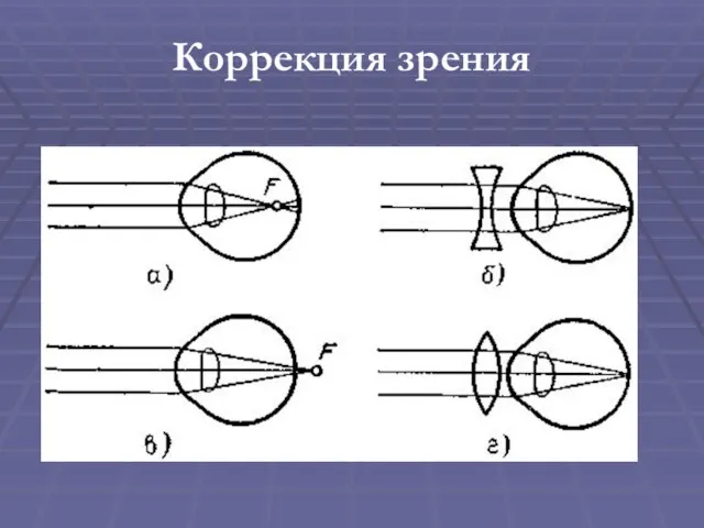 Коррекция зрения