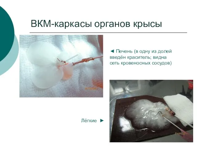 ВКМ-каркасы органов крысы ◄ Печень (в одну из долей введён краситель; видна