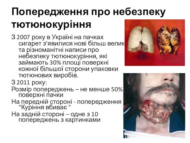 Попередження про небезпеку тютюнокуріння З 2007 року в Україні на пачках сигарет