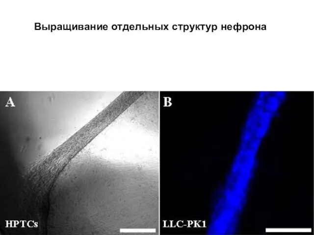 Выращивание отдельных структур нефрона