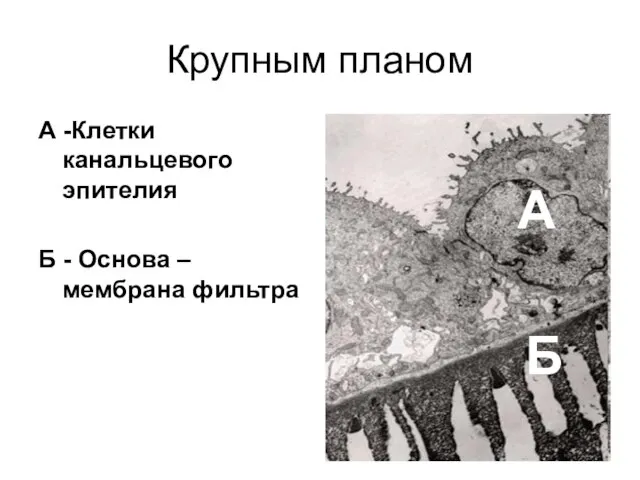 Крупным планом А -Клетки канальцевого эпителия Б - Основа – мембрана фильтра А Б