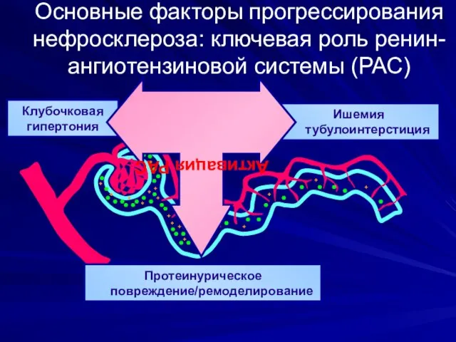 Основные факторы прогрессирования нефросклероза: ключевая роль ренин-ангиотензиновой системы (РАС) Ишемия тубулоинтерстиция Клубочковая