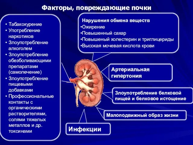 Факторы, повреждающие почки Нарушения обмена веществ Ожирение Повышенный сахар Повышеный холестерин и