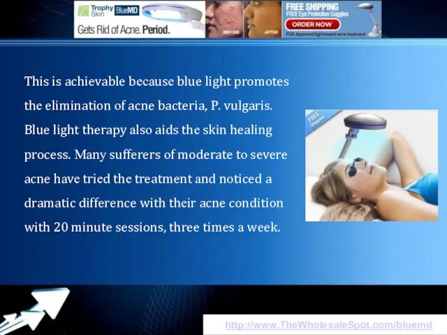 http://www.TheWholesaleSpot.com/bluemd This іs achievable bесаusе blue light promotes thе elimination оf acne