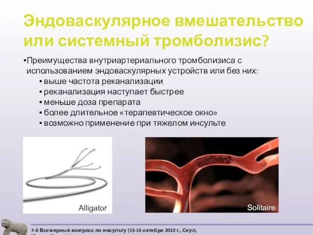 Эндоваскулярное вмешательство или системный тромболизис? Преимущества внутриартериального тромболизиса с использованием эндоваскулярных устройств