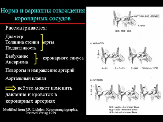 Modified from P.R. Lichtlen: Koronarangiographie, Perimed Verlag 1979 Норма и варианты отхождения