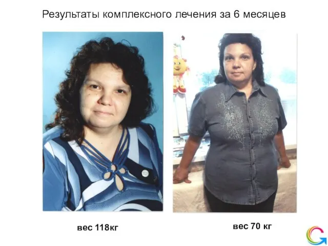 Результаты комплексного лечения за 6 месяцев вес 118кг вес 70 кг