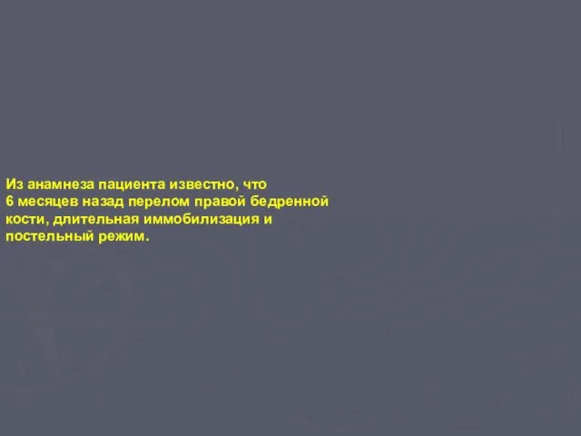 Из анамнеза пациента известно, что 6 месяцев назад перелом правой бедренной кости,