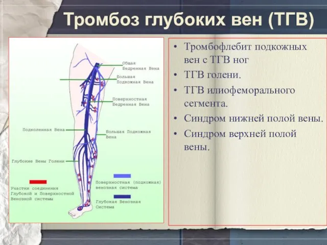 Тромбоз глубоких вен (ТГВ) Тромбофлебит подкожных вен с ТГВ ног ТГВ голени.