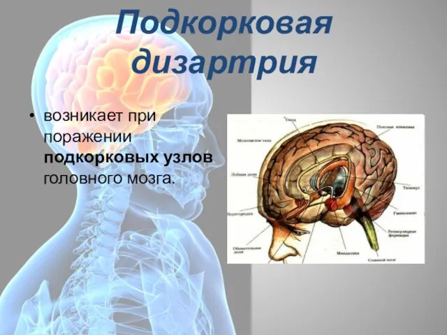 Подкорковая дизартрия возникает при поражении подкорковых узлов головного мозга.