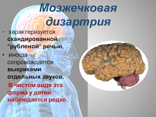 Мозжечковая дизартрия характеризуется скандированной "рубленой" речью, иногда сопровождается выкриками отдельных звуков. В