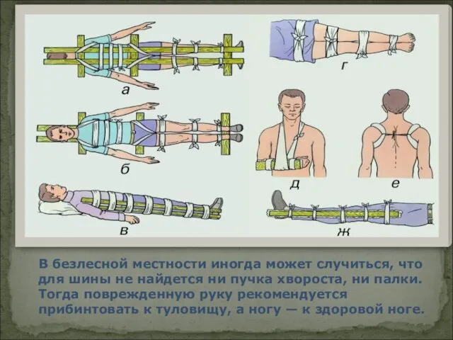 В безлесной местности иногда может случиться, что для шины не найдется ни