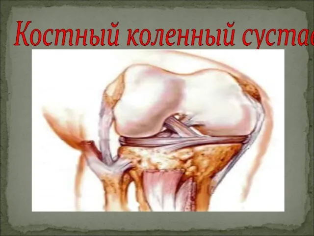 Костный коленный сустав