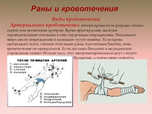 Раны и кровотечения Виды кровотечений Артериальное кровотечение: потеря крови из-за разрыва стенки