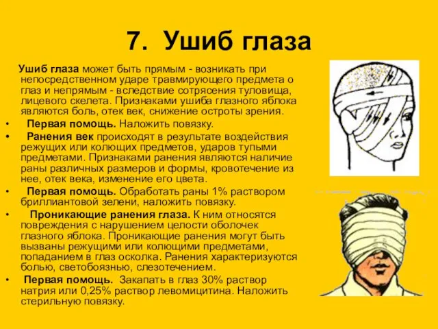 7. Ушиб глаза Ушиб глаза может быть прямым - возникать при непосредственном