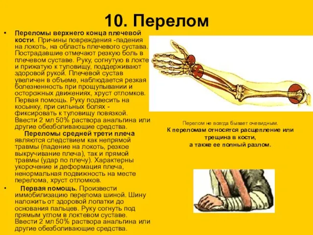 10. Перелом Переломы верхнего конца плечевой кости. Причины повреждения -падения на локоть,
