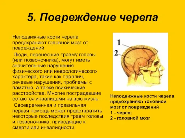 5. Повреждение черепа Неподвижные кости черепа предохраняют головной мозг от повреждений Люди,