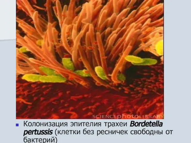Колонизация эпителия трахеи Bordetella pertussis (клетки без ресничек свободны от бактерий)