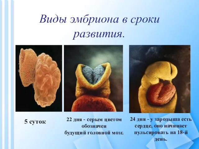 Виды эмбриона в сроки развития. 22 дня - серым цветом обозначен будущий
