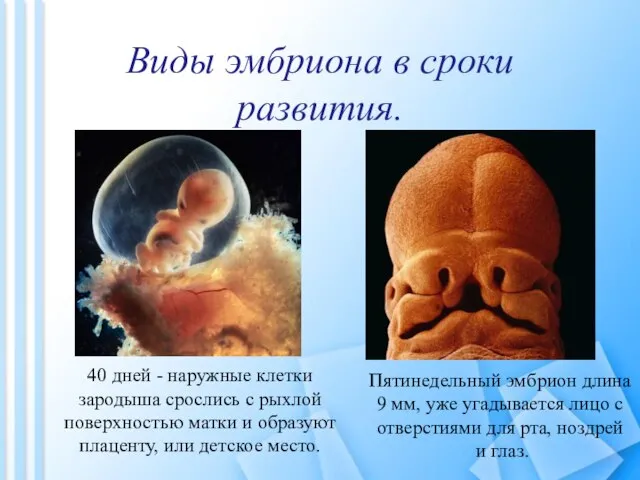 Виды эмбриона в сроки развития. Пятинедельный эмбрион длина 9 мм, уже угадывается